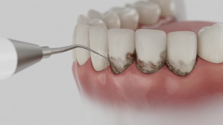 Reliable Teeth Cleaning And Checkup contractor in McMillin, WA by Smile Center Dentistry